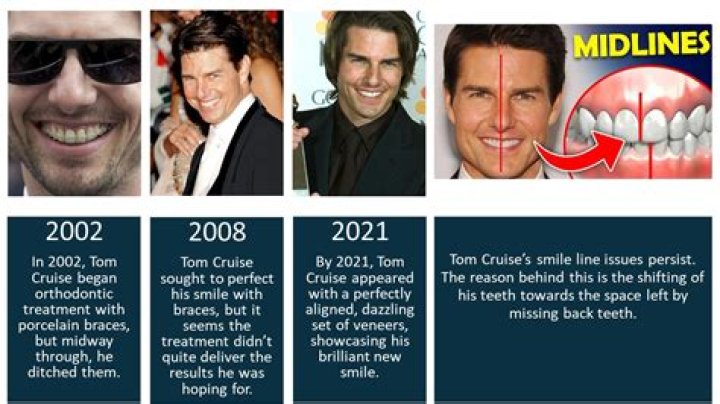 Unveiling The Secrets Behind Tom Cruise's Three Front Teeth: Discoveries And Insights